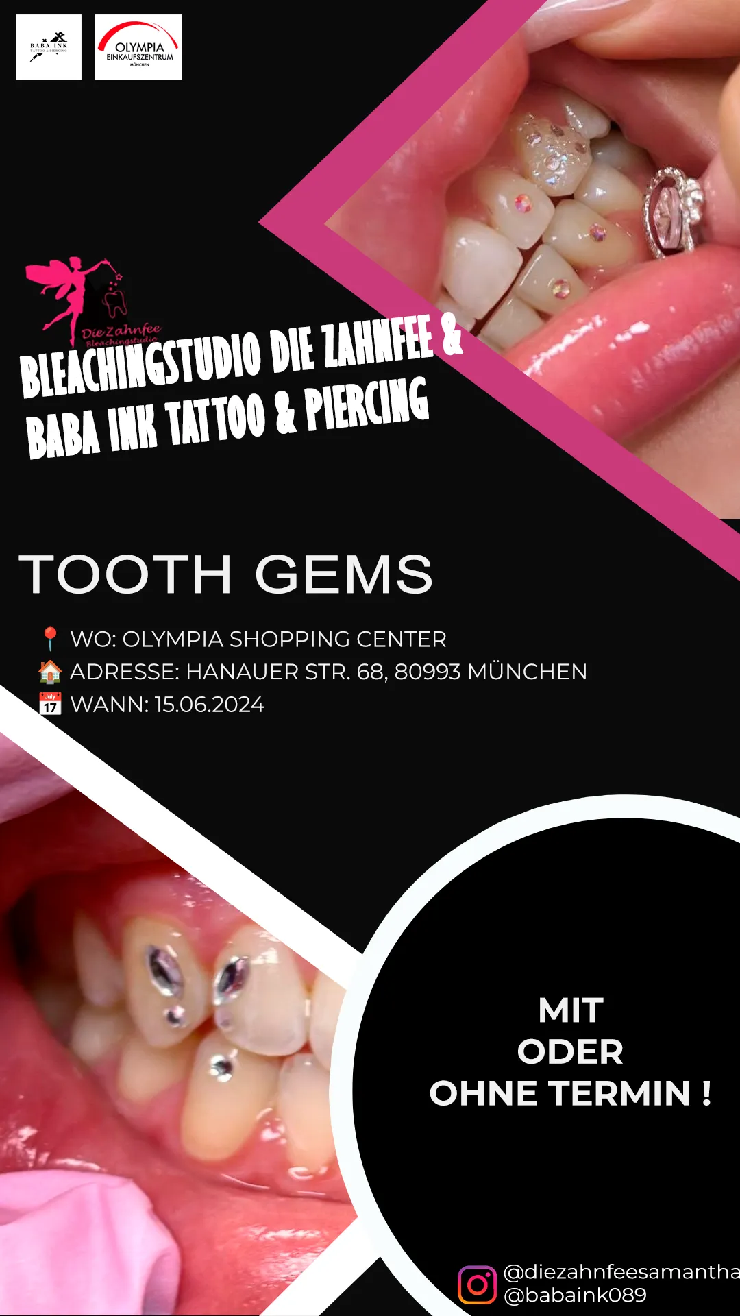 Zahnschmuck-Werbung mit Nahaufnahme von Zähnen mit glitzernden Edelsteinen